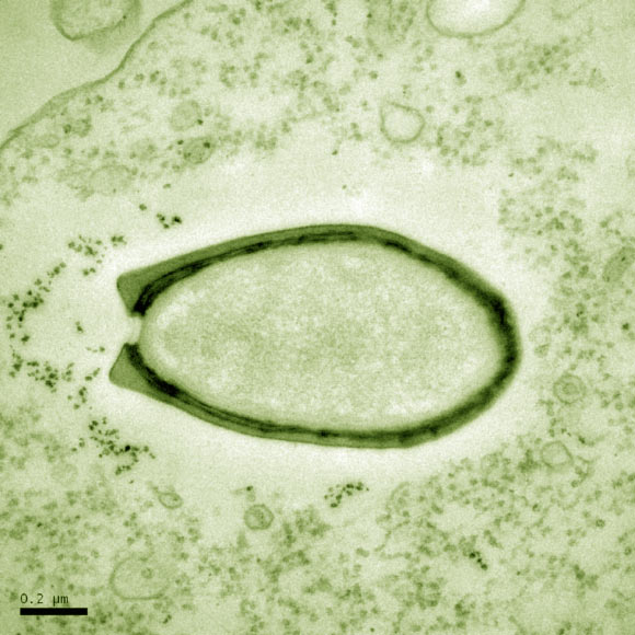 Pandoravirus dulcis (© IGS CNRS-AMU)