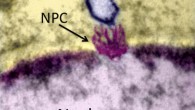Dr Alex Evilevitch and his colleagues provide the first experimental evidence of a high internal pressure of tens of atmospheres within Herpes simplex virus 1, resulting from the confined genome. NPC - nuclear pore complex (Bauer DW et al)