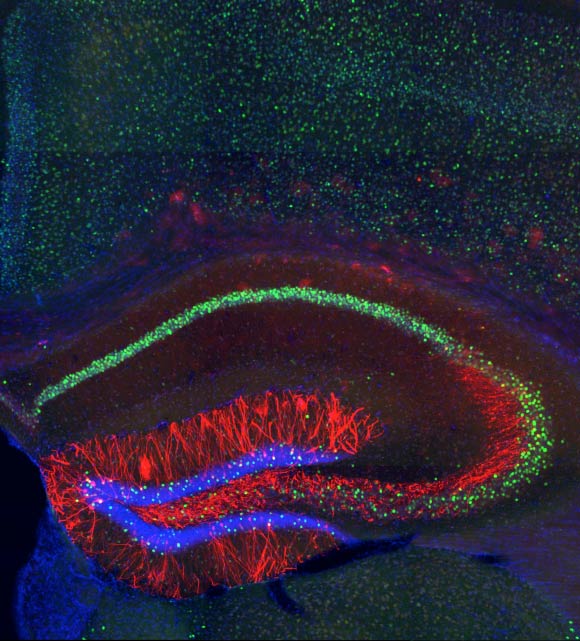 The team identified cells, shown in red, in the mouse hippocampus where memory traces are stored (Steve Ramirez / Xu Liu)