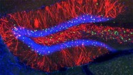 The team identified cells, shown in red, in the mouse hippocampus where memory traces are stored (Steve Ramirez / Xu Liu)