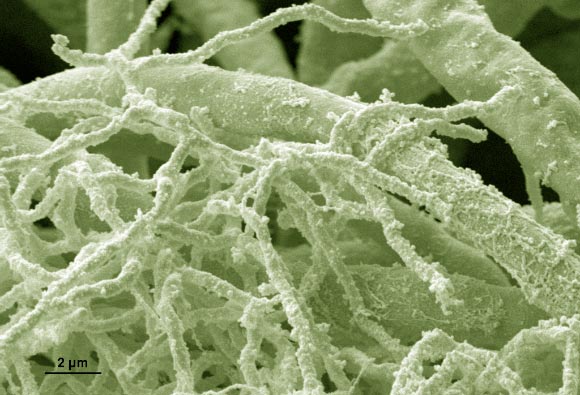 Rapamycin is an immunosuppressant that has been isolated from the bacterium Streptomyces hygroscopicus found in soil samples from Easter Island. The image shows co-culture of Streptomyces hygroscopicus with Aspergillus nidulans (HKI / FSU)