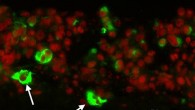 This image shows immunofluorescent staining of in vitro cultured urine-derived stem cells (Shaofeng Wu et al., 2011).