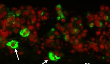 This image shows immunofluorescent staining of in vitro cultured urine-derived stem cells (Shaofeng Wu et al., 2011).