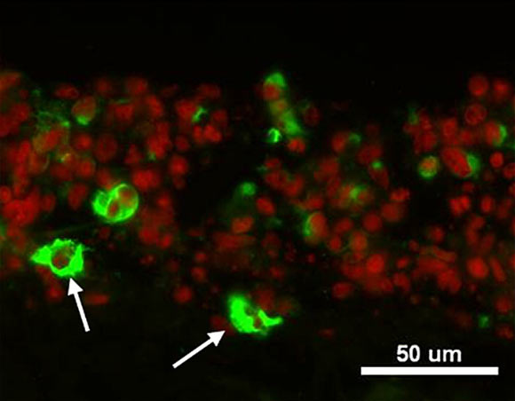 This image shows immunofluorescent staining of in vitro cultured urine-derived stem cells (Shaofeng Wu et al., 2011).