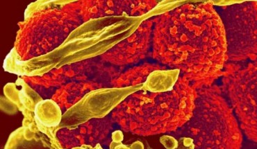Scanning electron micrograph of methicillin-resistant Staphylococcus aureus, yellow. Credit: NIAID.