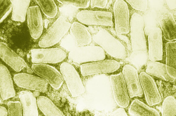 This electron micrograph shows particles of the vesicular stomatitis virus. Credit: Centers for Disease Control and Prevention.