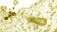 This electron micrograph shows particles of the Phoenix provirus resurrected from human DNA in 2006. Scale bar - 200 nm (Marie Dewannieux et al).