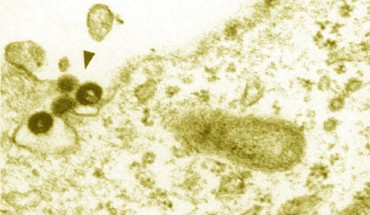 This electron micrograph shows particles of the Phoenix provirus resurrected from human DNA in 2006. Scale bar - 200 nm (Marie Dewannieux et al).