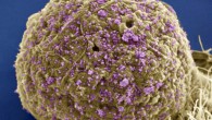 This scanning electron micrograph shows HIV particles attacking a cell (Thomas Deerinck / National Center for Microscopy Imaging Research).