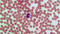 This image shows a monocyte - a type of white blood cell and part of the human body's immune system (Adam Orlando / University of Massachusetts Amherst).