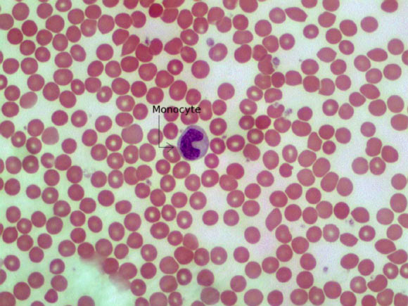 This image shows a monocyte - a type of white blood cell and part of the human body's immune system (Adam Orlando / University of Massachusetts Amherst).
