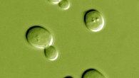Studies in the yeast Saccharomyces cerevisiae, shown here, over the past two decades have found a connection between rDNA genes and lifespan.