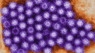 This electron micrograph shows norovirus virions. Image credit: CDC.