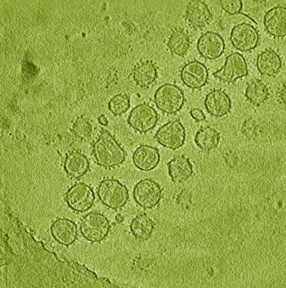 Particles of simian immunodeficiency virus. Image credit: Tom Goddard / University of California, San Francisco.
