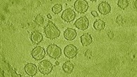 Particles of simian immunodeficiency virus. Image credit: Tom Goddard / University of California, San Francisco.