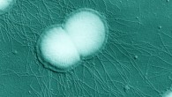 This scanning electron micrograph shows Neisseria gonorrhoeae diplococci. Image credit: Charles Brinton / National Institutes of Health.