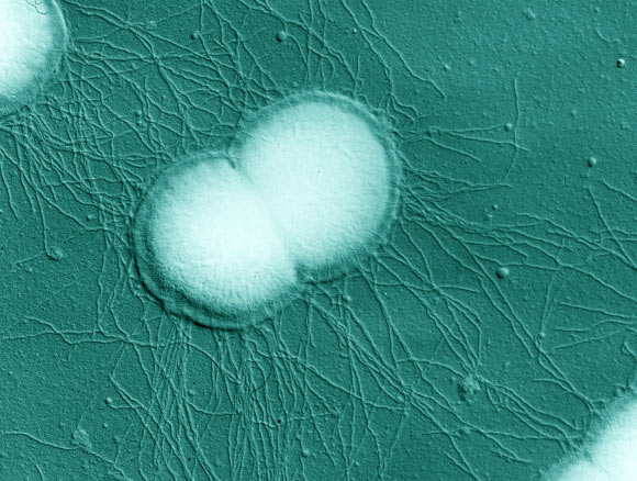 This scanning electron micrograph shows Neisseria gonorrhoeae diplococci. Image credit: Charles Brinton / National Institutes of Health.