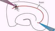 Acute brain slice: thin brain slices allow the selective study of a neural circuit in isolation not possible in intact organism; here one can also selectively manipulate the conditions and observe their specific effect. Image credit: Bhuminder Singh.