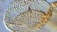 This image shows a 240-million-year-old pollen grain from northern Switzerland, scale bar - 10 μm. Image credit: Hochuli PA and Feist-Burkhardt S.