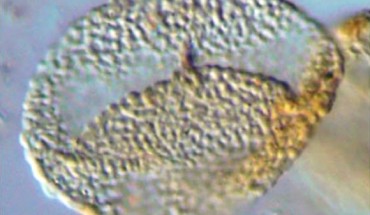 This image shows a 240-million-year-old pollen grain from northern Switzerland, scale bar - 10 μm. Image credit: Hochuli PA and Feist-Burkhardt S.