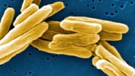 This colorized scanning electron micrograph shows Mycobacterium tuberculosis, gram-positive bacteria that cause tuberculosis. Image credit: Ray Butler / Centers for Disease Control and Prevention.