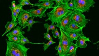 This fluorescence image shows endothelial cells. Image credit: Kandasamy, Biomedical Microscopy Core, Paul D. Coverdell Center.