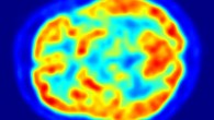 Researchers mapped brain activity when volunteers read poetry and prose. The results show that poetry is like music to the human mind. Image credit: Jens Langner.