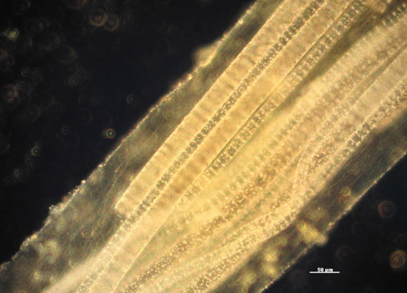This image shows the recently discovered species of sulfur-oxidizing Thioploca bacteria. Image credit: Nathan Magarvey.