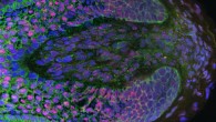 This image shows dermal papilla cells. Image credit: Claire Higgins / Columbia University Medical Center.