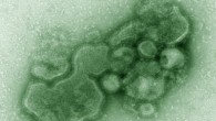 This image shows H7N9 virions. Image credit: Cynthia S. Goldsmith / Thomas Rowe.