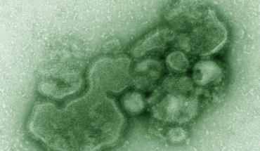 This image shows H7N9 virions. Image credit: Cynthia S. Goldsmith / Thomas Rowe.