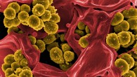 This scanning electron micrograph shows the methicillin-resistant Staphylococcus aureus. Image credit: NIAID.
