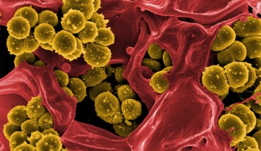 This scanning electron micrograph shows the methicillin-resistant Staphylococcus aureus. Image credit: NIAID.