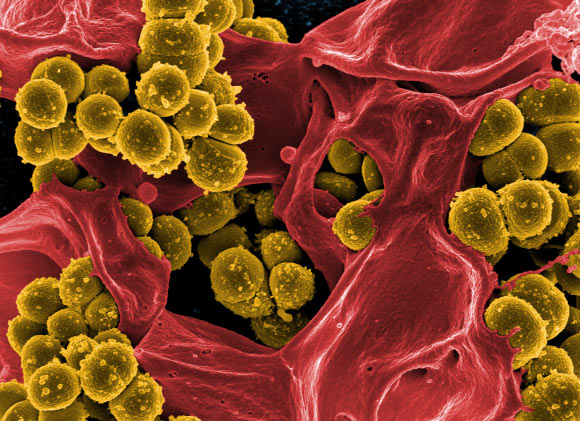 This scanning electron micrograph shows the methicillin-resistant Staphylococcus aureus. Image credit: NIAID.