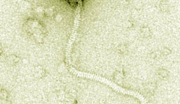 Electron microscopy of Tsamsa phage. Scale bar - 100 nm. Image credit: Ganz HH et al.