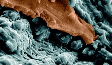 This SEM image shows spherulitic features encased in both an upper, false-colored orange, and lower layer of iddingsite. Image credit: White LM et al.
