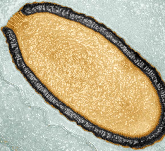 Pithovirus sibericum. Image credit: Julia Bartoli / Chantal Abergel / IGS / CNRS / AMU.
