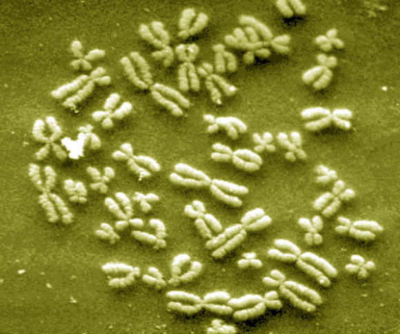 Chromosomes. Image credit: University of New Mexico.