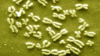 Chromosomes. Image credit: University of New Mexico.