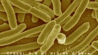 This false-color scanning electron micrograph shows Escherichia coli. Image credit: Rocky Mountain Laboratories / NIAID / NIH.