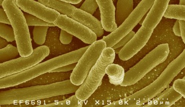 This false-color scanning electron micrograph shows Escherichia coli. Image credit: Rocky Mountain Laboratories / NIAID / NIH.