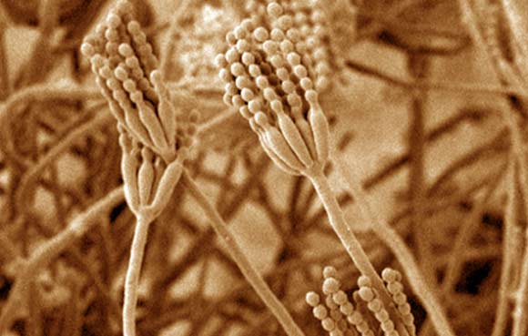Penicillium vanoranjei. Image credit: Cobus M. Visagie / Jan Dijksterhuis.