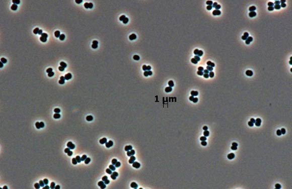 Tersicoccus phoenicis. Image credit: Leibniz-Institute DSMZ / Jet Propulsion Laboratory, California Institute of Technology.