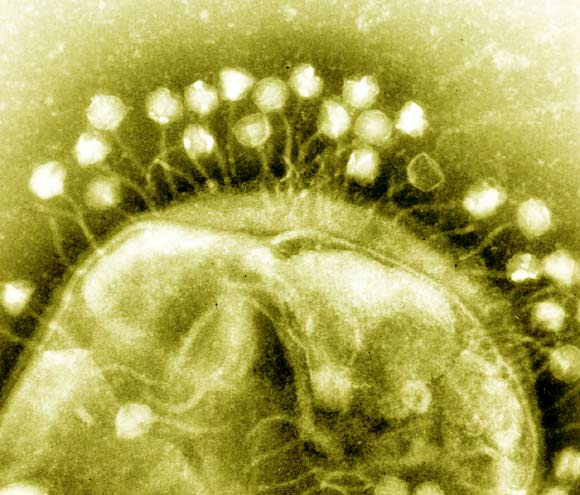 Electron micrograph of bacteriophages infecting a bacterial cell. Image credit: Dr Graham Beards.