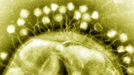 Electron micrograph of bacteriophages infecting a bacterial cell. Image credit: Dr Graham Beards.