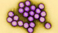 Colorized transmission electron micrograph of adenovirus. Image credit: Dr G. William Gary, Jr. / CDC.