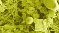 This false-color scanning electron microscopy image shows a microbial cell (arrow) with coccoid morphology found in a sample from Lake Whillans. Scale bar - 2 μm. Image credit: Brent C. Christner et al.