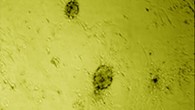 A false-color image of stem cells from human corneal limbus. Scale bar - 100 µm. Image credit: Chen X et al.