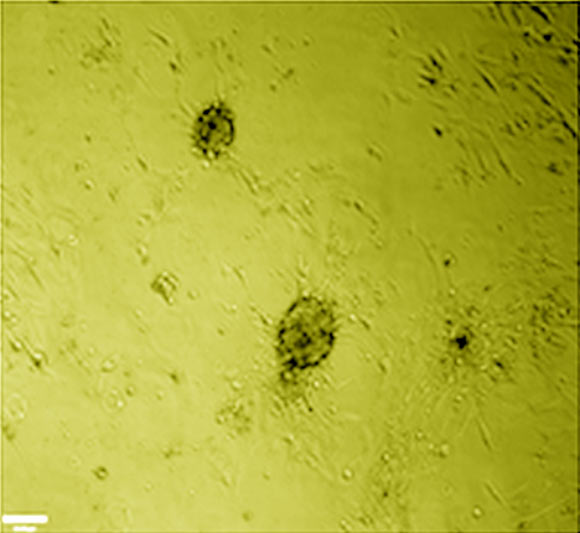 A false-color image of stem cells from human corneal limbus. Scale bar - 100 µm. Image credit: Chen X et al.