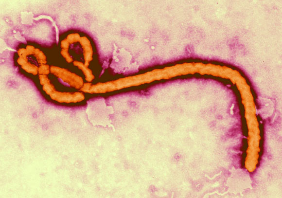 Transmission electron micrograph of an Ebola virus virion. Image credit: Frederick Murphy / CDC.